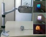 Medical Infrared Vein Finder Accurate for Projecting Human Skin Vein Imaging