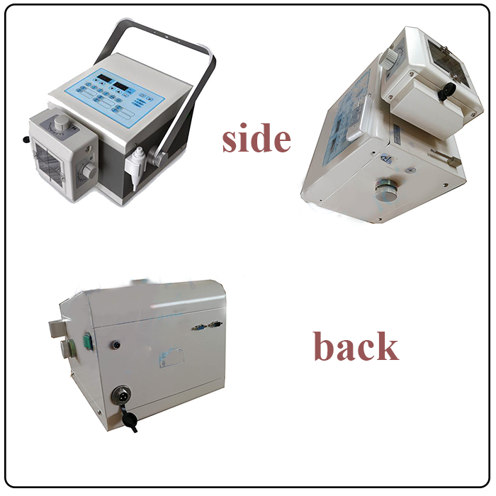 Portable X Ray Equipment Metal Ce Medical X-ray Equipment